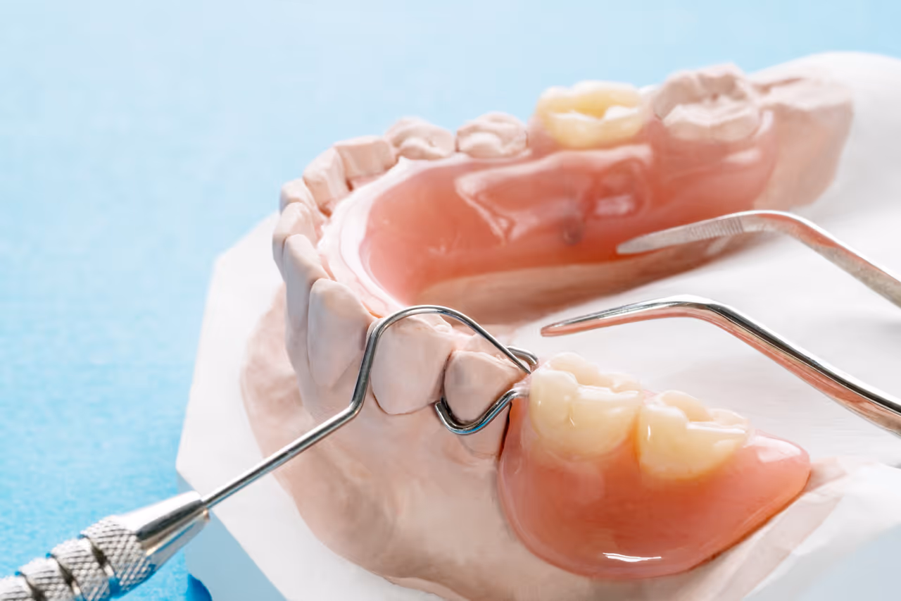 Is a Partial Denture the Same As a Bridge?