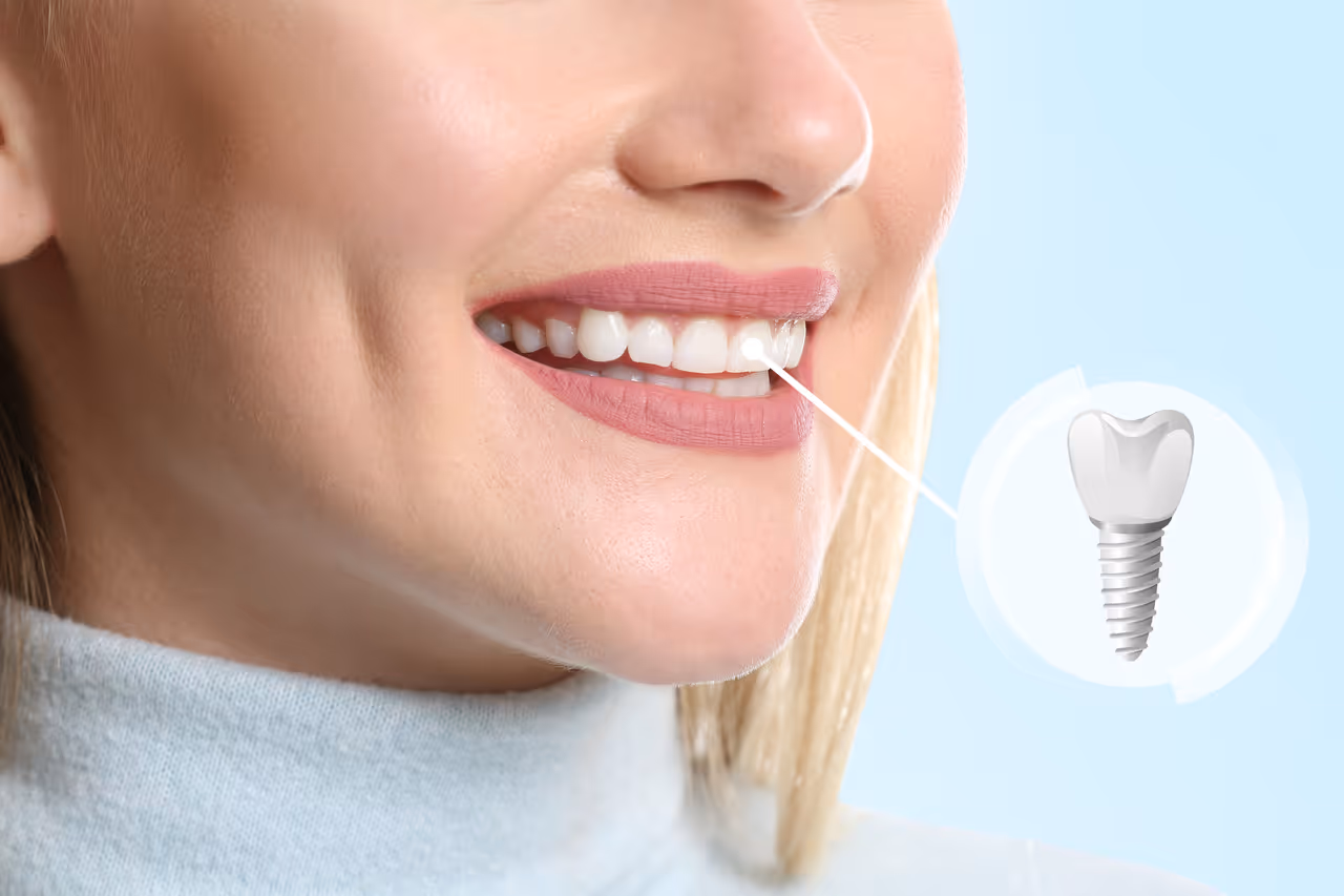 How to Relieve Pain From a Dental Implant?