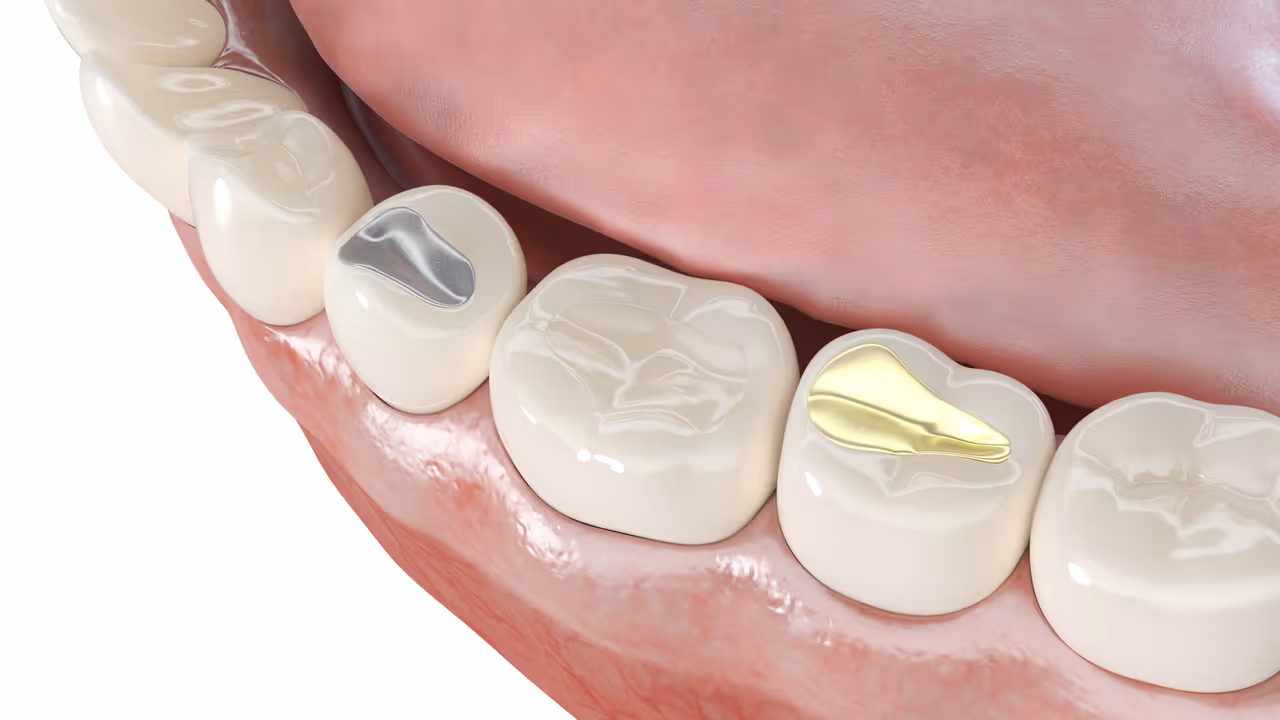 How Long Does It Take to Fill Three Cavities?