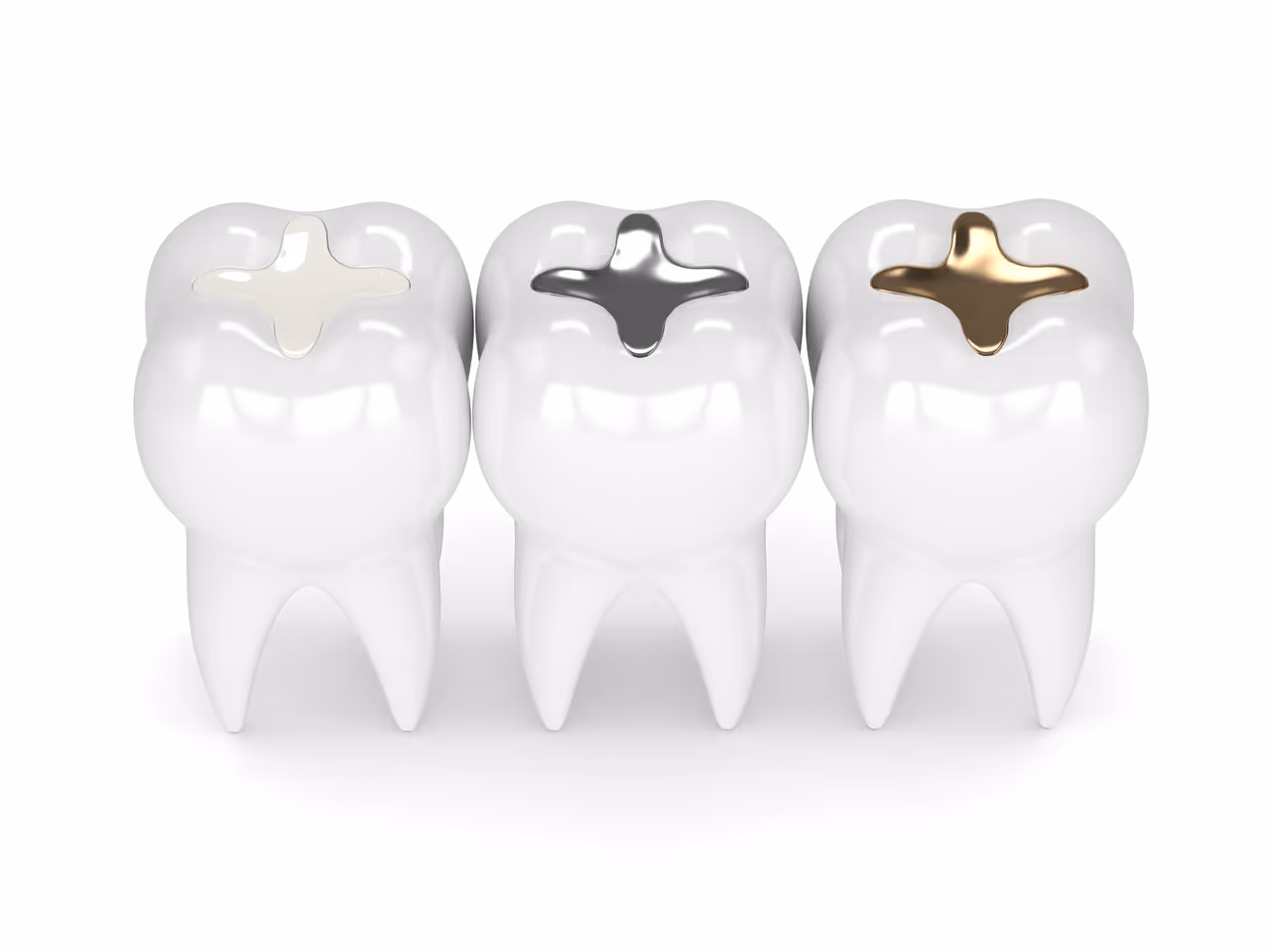 What Material Options Exist for Dental Fillings? Pros and Cons