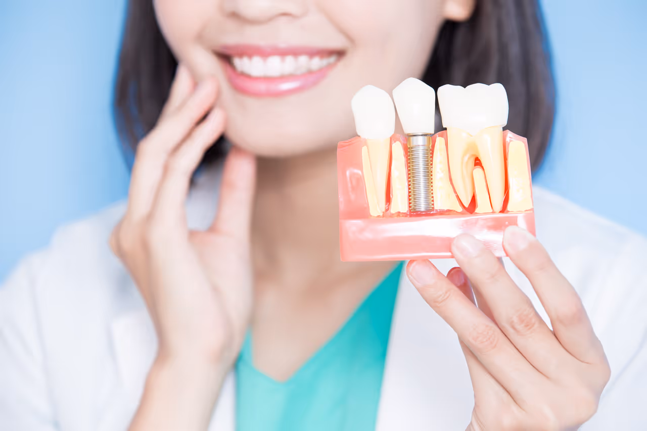 Understanding in Detail the Role of the Abutment in Dental Implants
