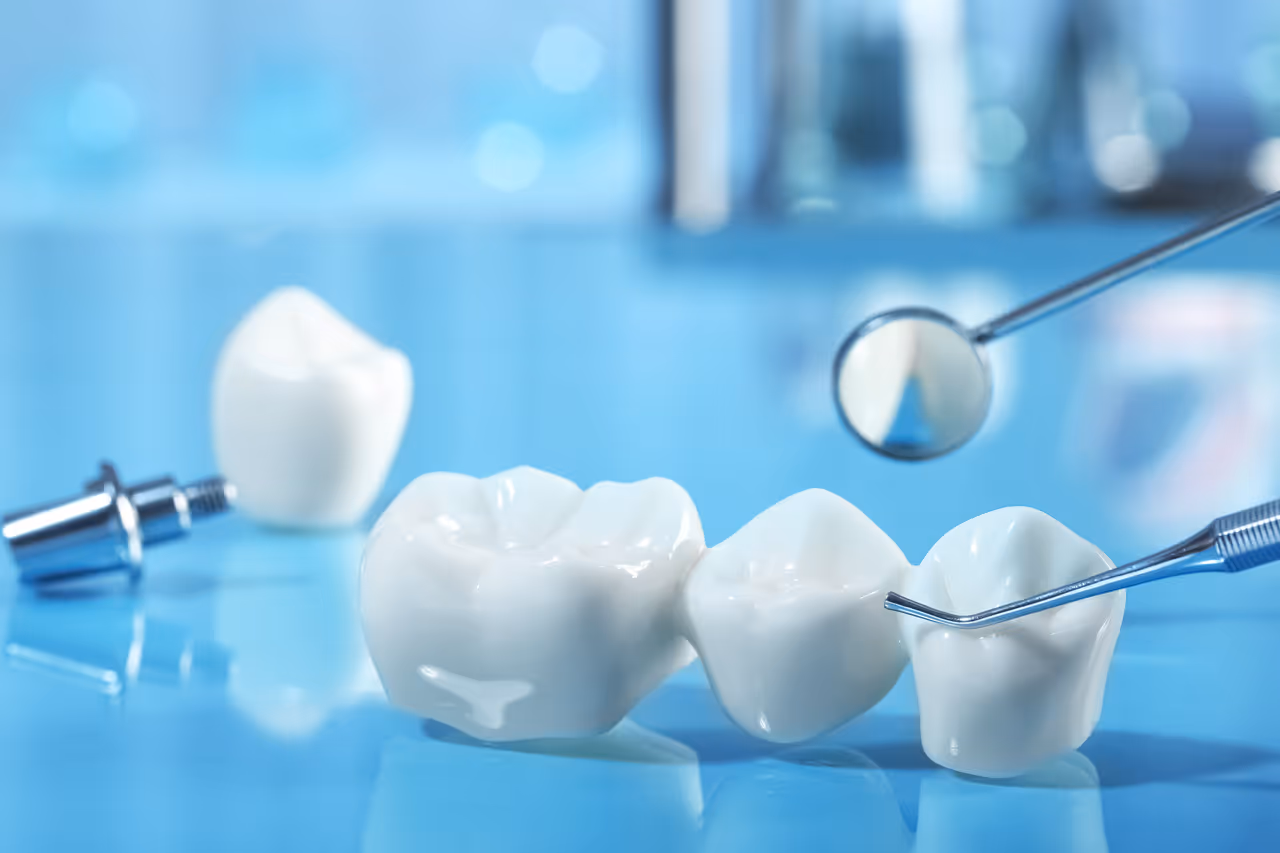 The Benefits of Same-Day Crowns: Quick and Convenient