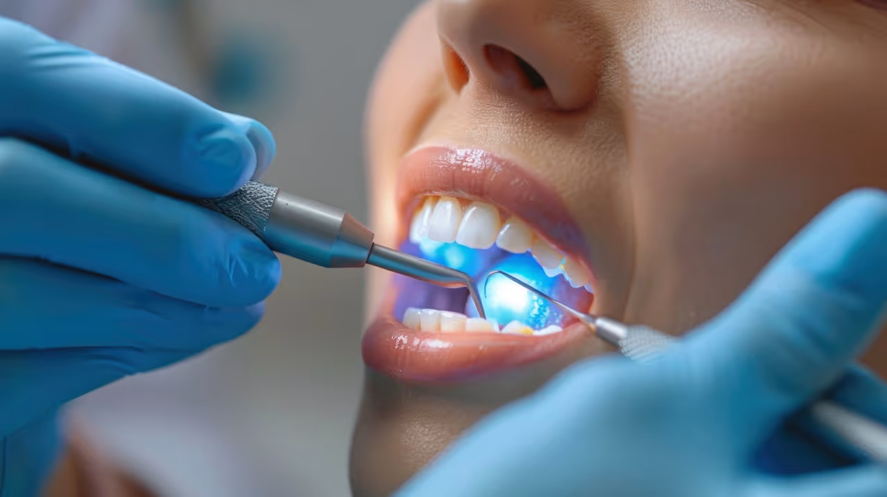 How Tooth Extractions Prevent Infection From Spreading to Nearby Teeth