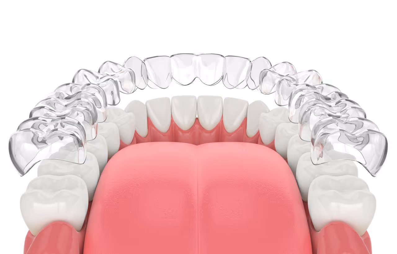 How Invisalign Treatment Supports Better Long-Term Oral Health